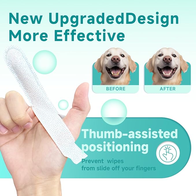 Pet Dental Finger Wipes for Dogs & Cats, Dog Teeth Cleaning Wipes Tooth Brushing Kit by Remove Plaque and Tartar & Freshens Breath Buildup No-Rinse Dog Finger Toothbrush